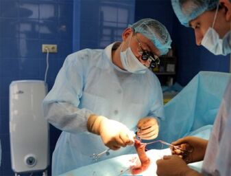 Operace zvětšení penisu prováděná chirurgy